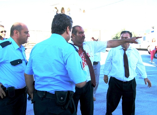 Polis benzetmesiyle adam dövdü